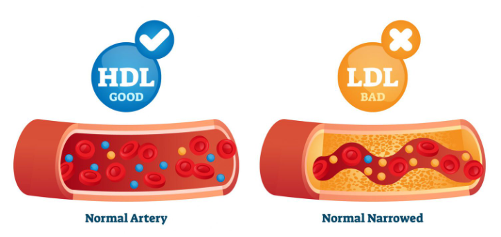השוואה HDL, LDL